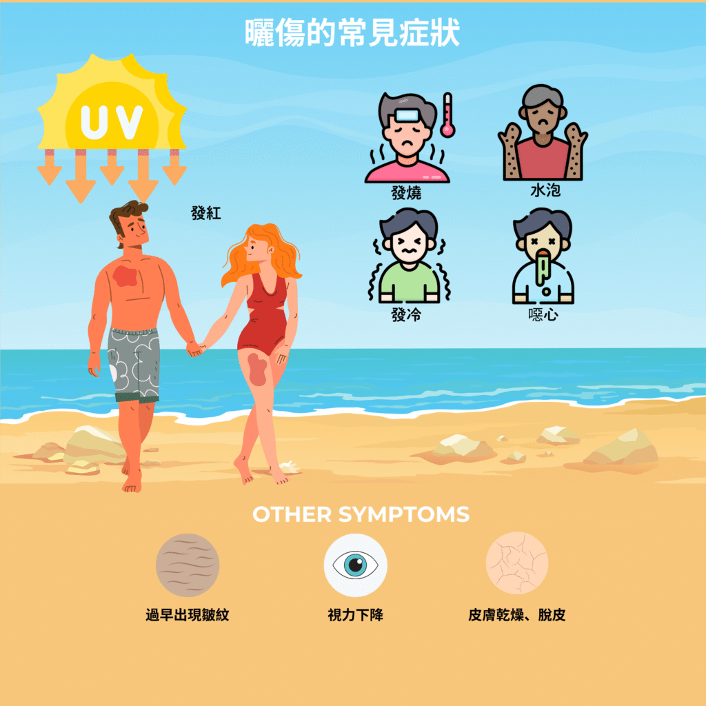 曬傷的常見症狀