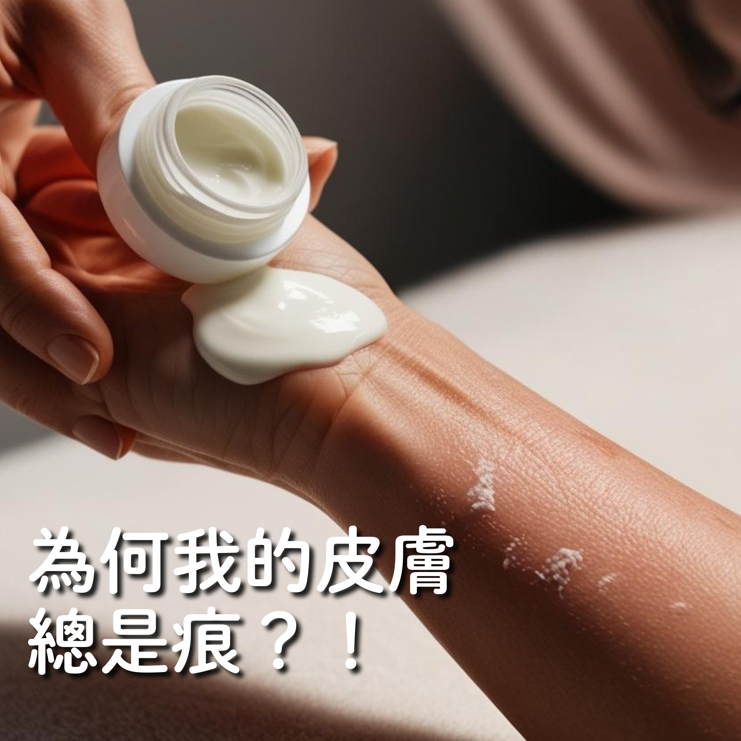 Blog list featured image